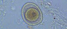 Helminthiasis1